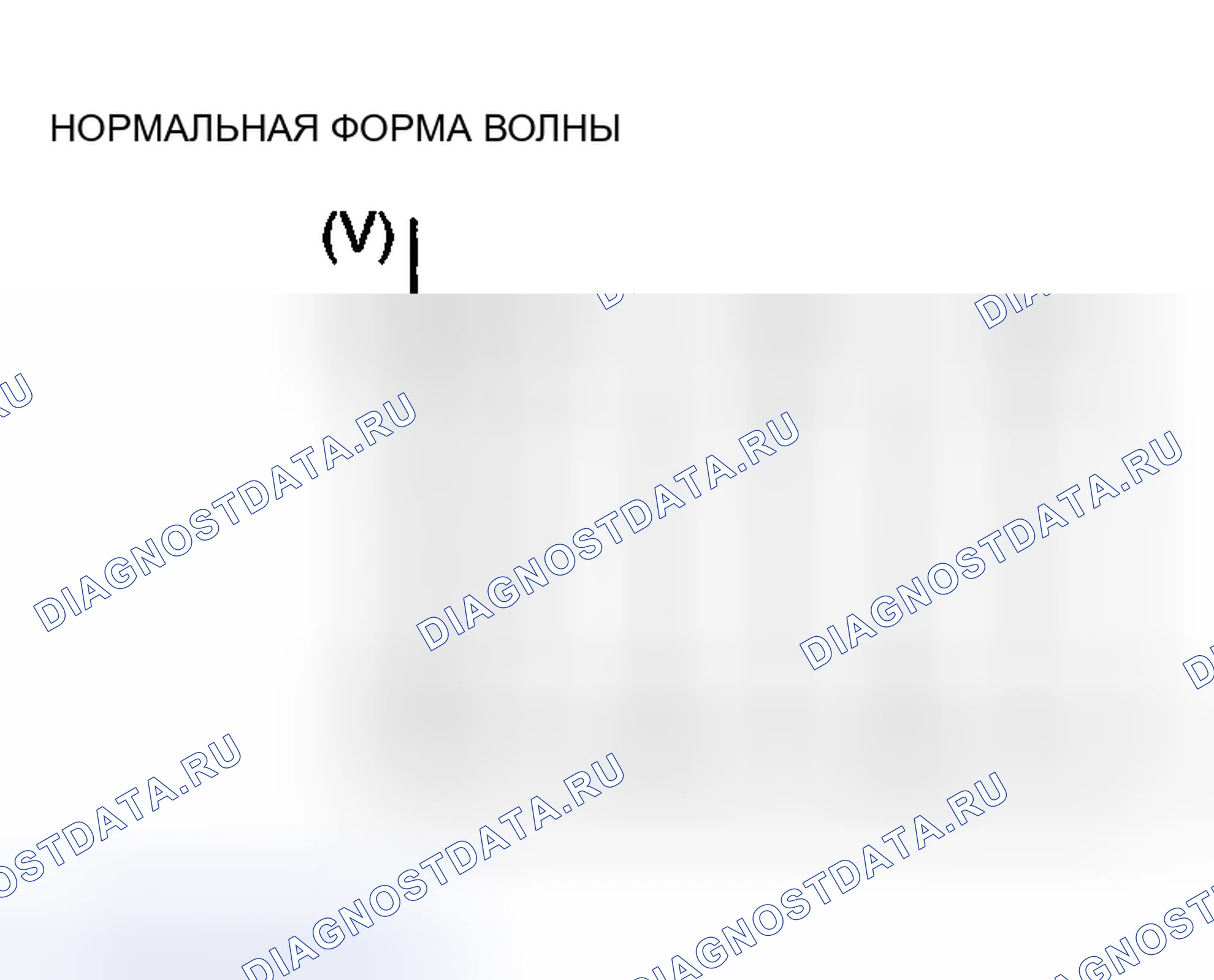Рис. 17. Mitsubishi Eclipse III