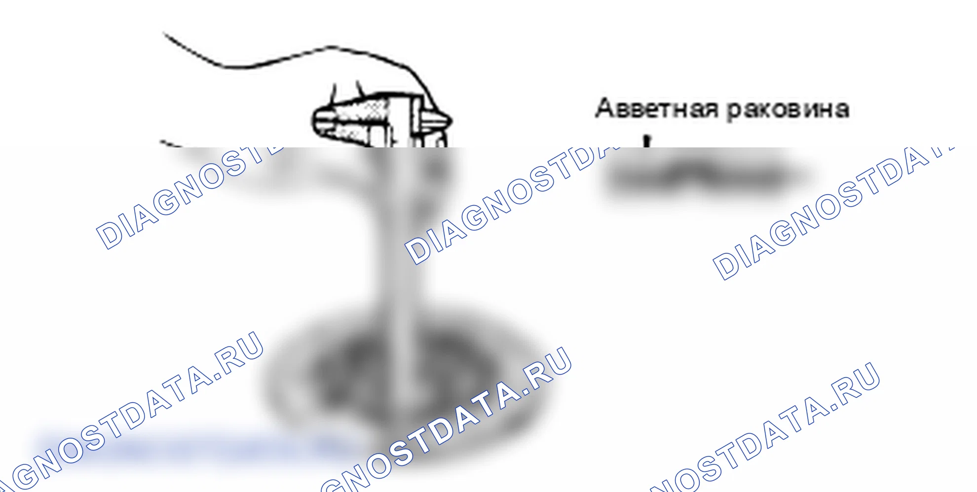 Проверка кожуха и диска сцепления. Hyundai Atos MX