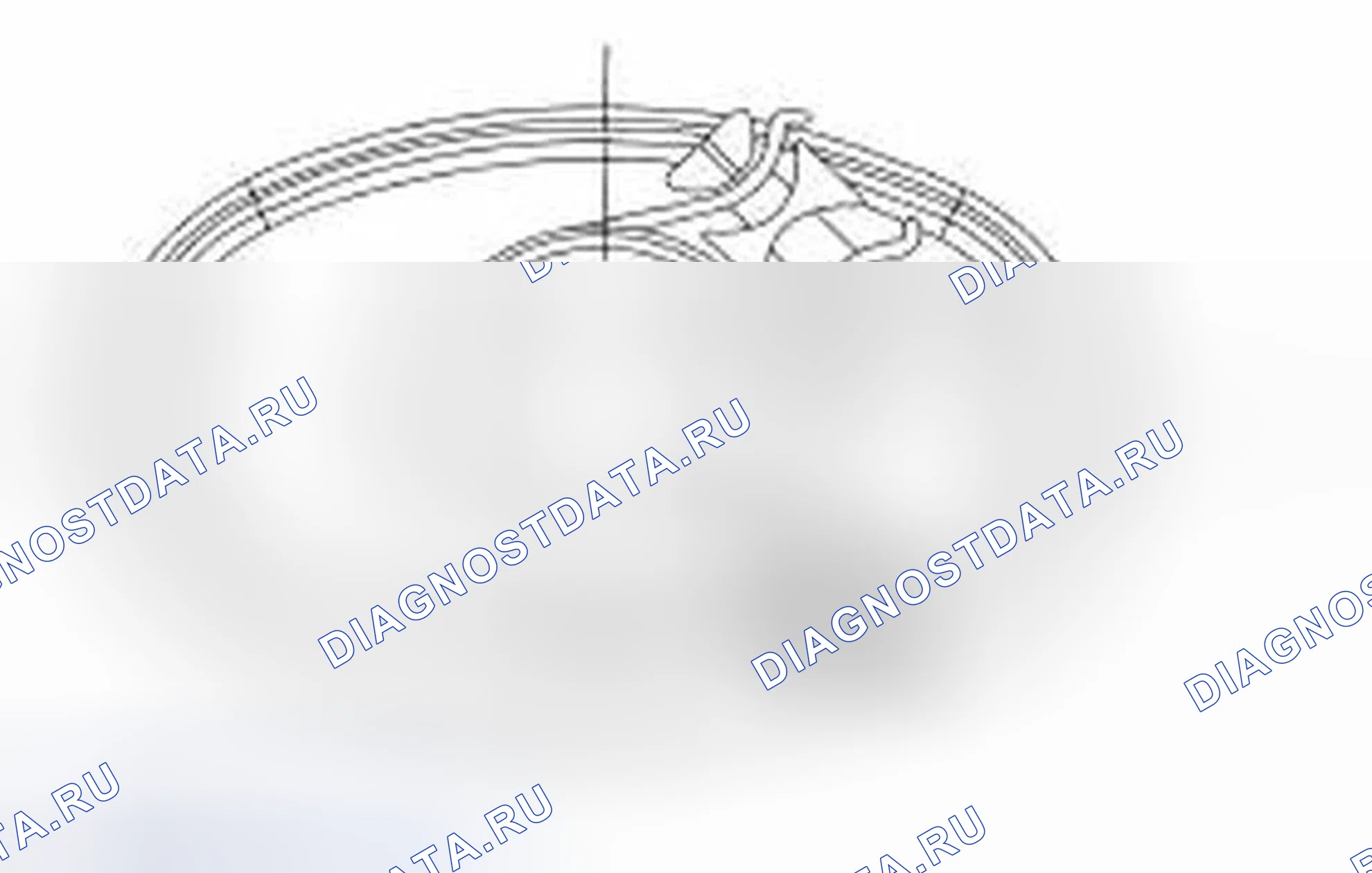 Рис. 3: Зажим Torca ®. Ford Freestyle I