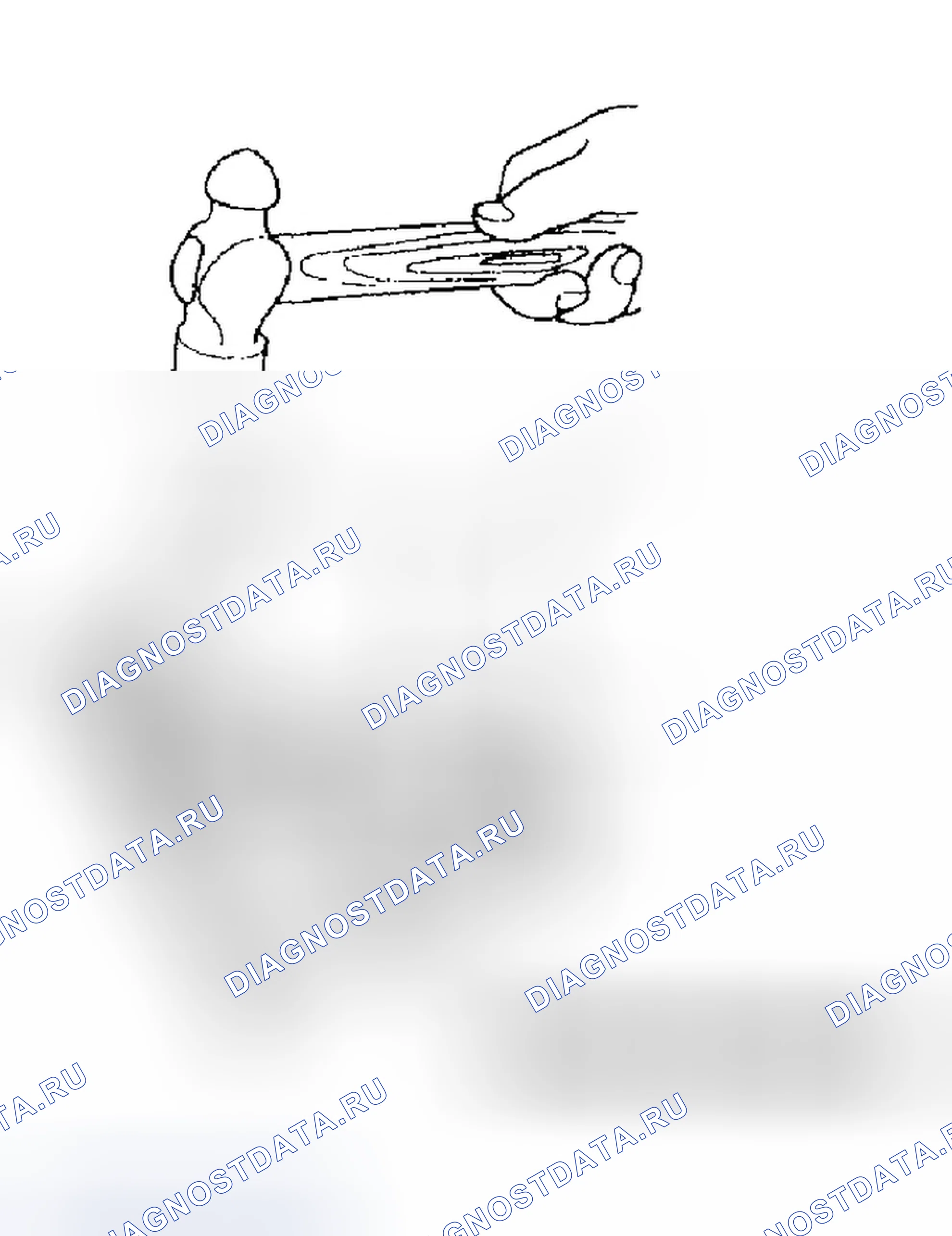 Рис. 17: Установка. Honda Odyssey II