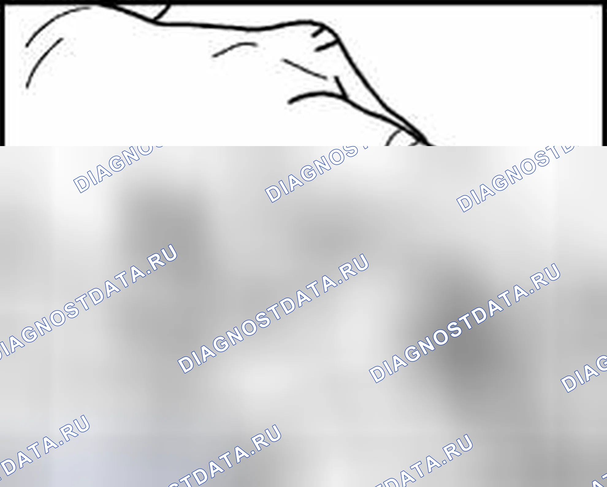 Рис. 169: Фитинговый колпачок. Volkswagen Golf Mk4