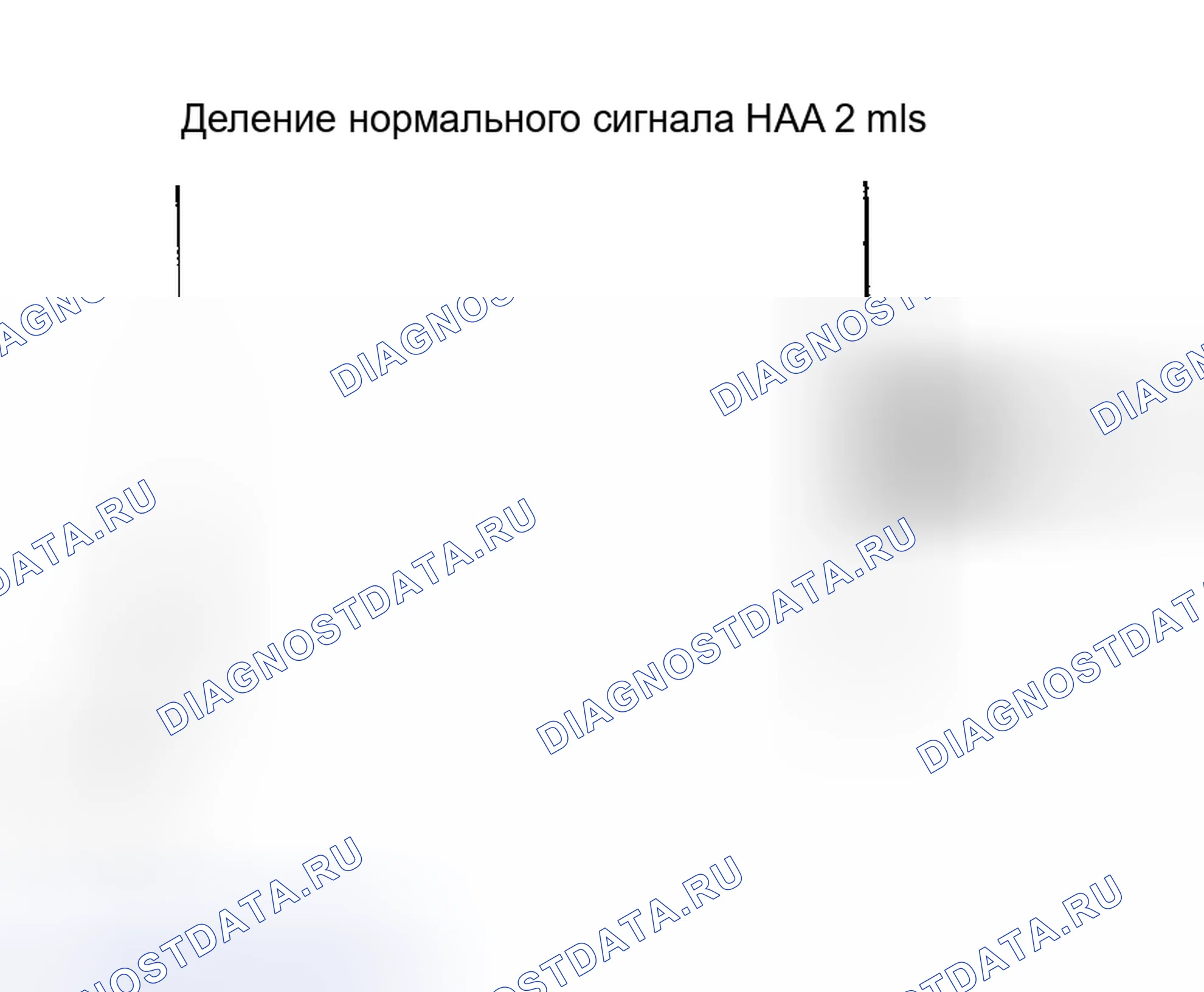 Рис. 31. Toyota Avalon XX20 рестайлинг