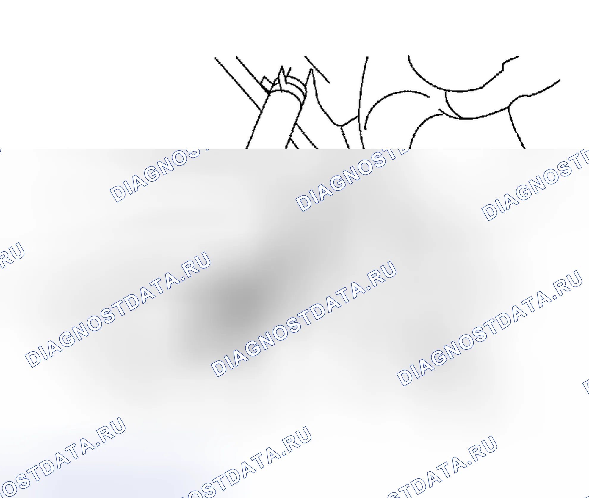 Рис. 60. Subaru Impreza GD/GC/GG рестайлинг