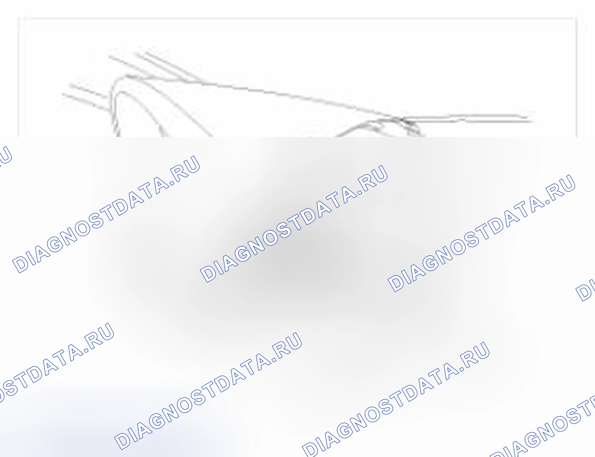 Рис. 6. Hyundai Accent IV