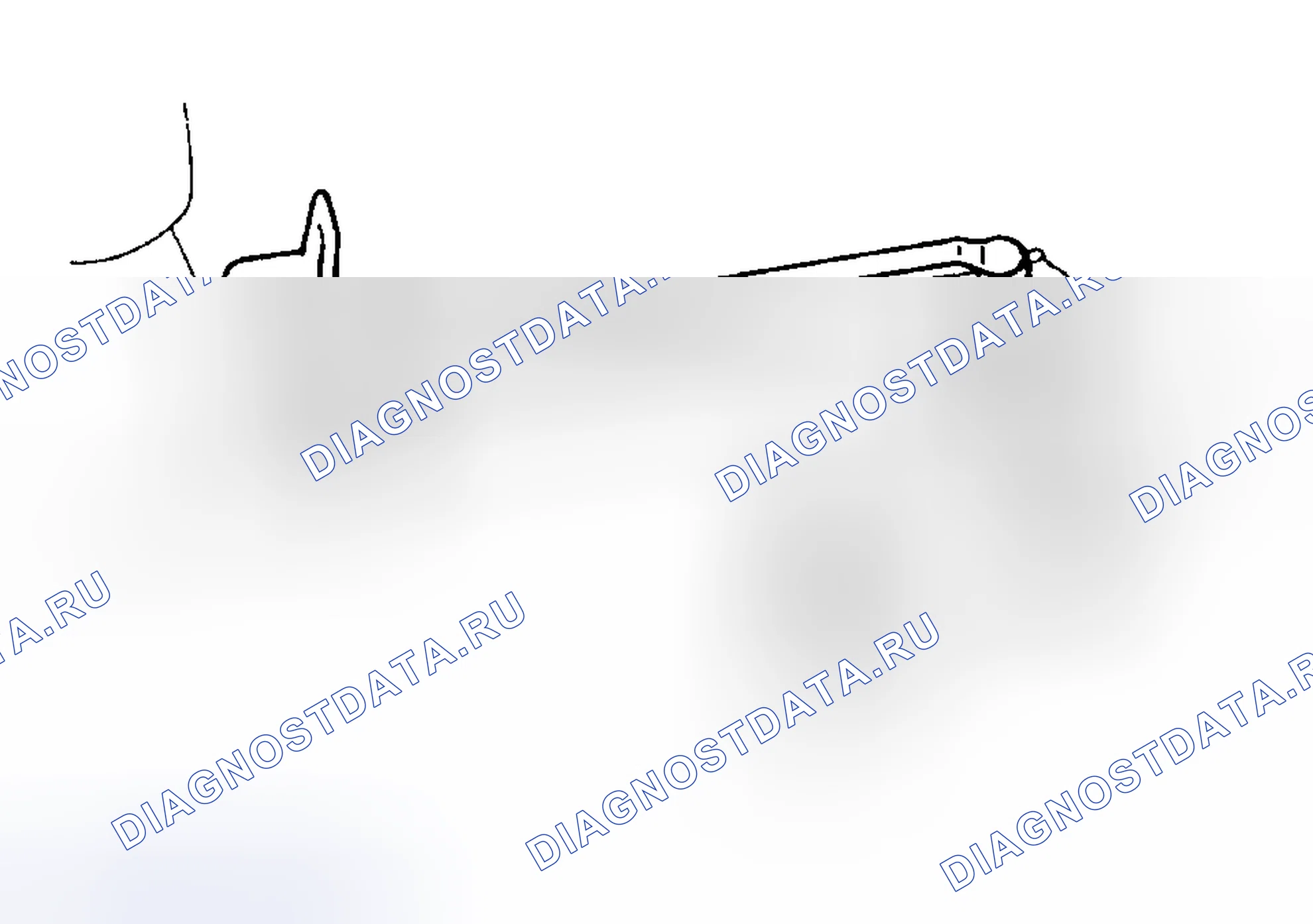 Рис. 20: Повторная сборка. Lexus ES V20