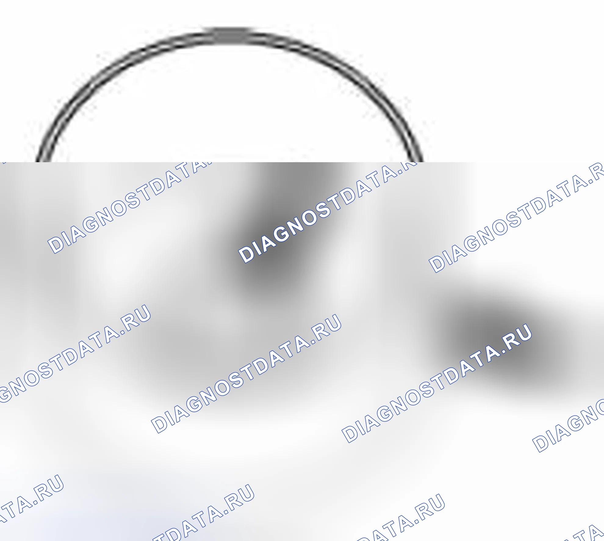 Рис. 158: Износ Tappet. Suzuki Grand Vitara II рестайлинг 2