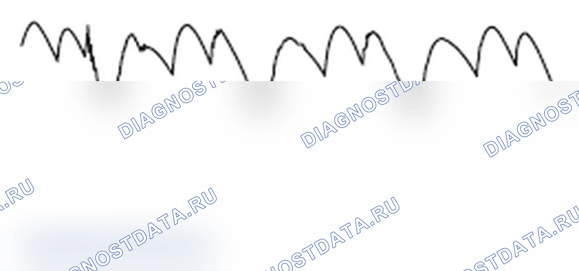 Рис. 159. Mitsubishi Lancer Ralliart X рестайлинг